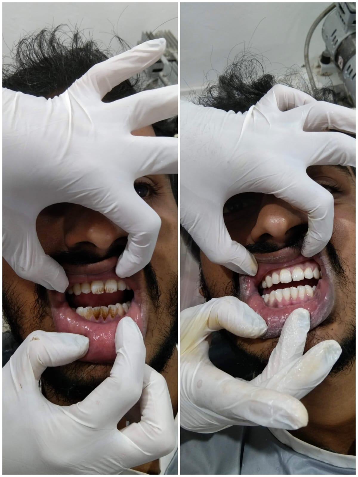Specialized Dental Care for Children with Special Needs: A Compassionate Approach
